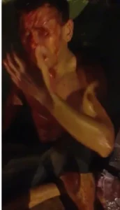 Acusado de estuprar criança leva “coça” de moradores de Teresina/PI