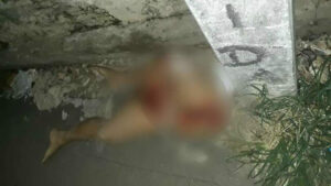 Pernas de mulher são encontradas jogadas em beco de Manaus