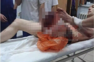 Homem serra a própria perna após misturar “droga zumbi” com remédios