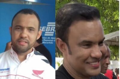Vídeo: Prefeito surge com implante de cabelo e harmonização facial e vídeo viraliza nas redes sociais