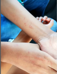 Criança autista é agredida em escola municipal de São Luís