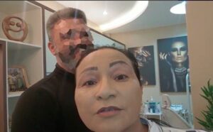Deputada tem mandato cassado acusada de pagar harmonização facial com dinheiro de campanha