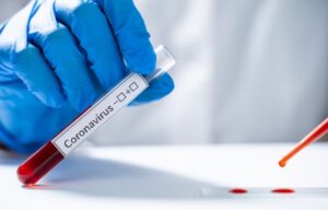 Maranhão registra mais 591 casos e 11 óbitos por Covid-19