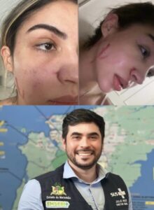 Diretor de UPA é afastado do cargo por suposta agressão à ex-namorada