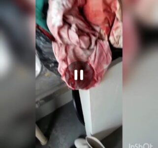 Vereadores denunciam descaso da Prefeitura de Anapurus com a Saúde