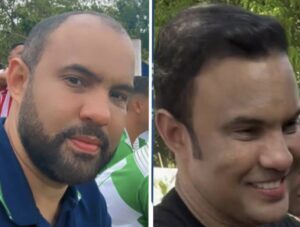 Prefeito ostentação surge com implante de cabelo e harmonização facial e vídeo viraliza nas redes sociais
