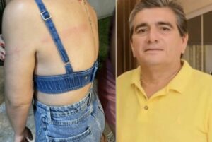 Marido da prefeita de Anapurus é acusado de espancar a filha com facão
