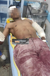 Dupla efetua disparo contra guarnição da PM em Chapadinha; Um dos indivíduos é foragido da Justiça, foi baleado e preso