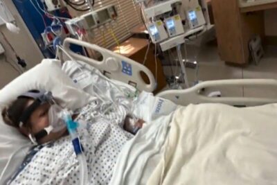 Mulher tem braços e pernas amputados após comer tilápia mal passada