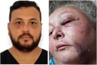 Médico preso por torturar a namorada é acusado de agressão contra a mãe