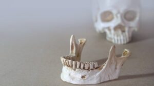 CRO/MA produz nota de repúdio fake para agredir jornalista e garantir aos odontólogos o direito de furar fila da vacina