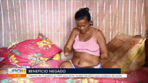 Mulher sem mãos e pernas tem pedido de benefício negado pelo INSS