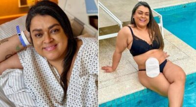 Cantora Preta Gil posta última foto com bolsa de ileostomia e celebra: ‘Mais perto do fim do tratamento’