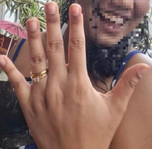 Após pedido de casamento, jovem morre ao cair do 3º andar em condomínio de São Luís