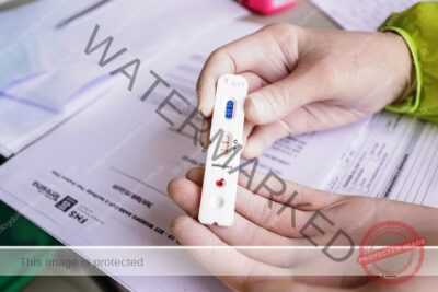 Farmácias e laboratórios registram maior procura por exame de covid após carnaval