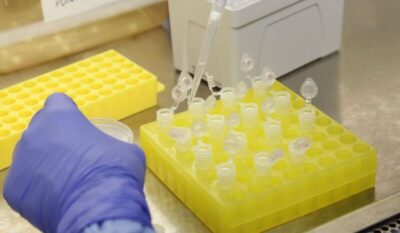 OMS faz recomendações temporárias para situações de surto por mpox