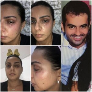 Empresário Soliney Silva agride a esposa com socos no carnaval