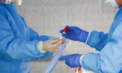 Brasil já ultrapassa 130,5 mil casos de covid-19 em 2025