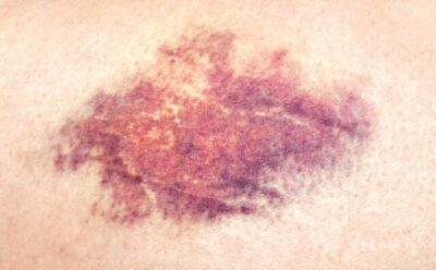 Você já ouviu falar do Exame de Corpo de Delito?