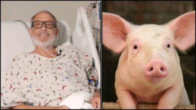 Segundo paciente que recebeu transplante experimental de coração de porco morre seis semanas após procedimento