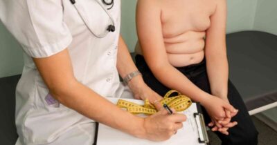 Obesidade afeta mais de 24 mil crianças no Maranhão