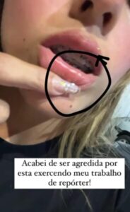 Repórter policial é agredida em Caxias