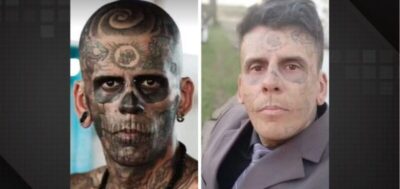 Homem ‘mais tatuado do Brasil’ passa por 3ª sessão de remoção de tatuagens