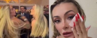 Andressa Urach leva pontos no rosto após briga com Juju Ferrari