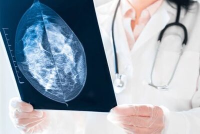 Sesc realiza exames gratuitos de mamografia e prevenção em São Luís