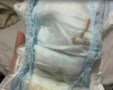 Mãe se desespera ao encontrar rato morto dentro da fralda lacrada usada no filho recém-nascido