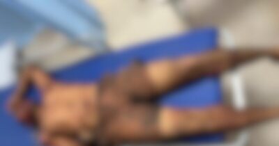 URGENTE! Faccionado que ateou fogo na viatura da Polícia Civil de Vargem Grande morre após confronto com policiais militares em Itapecuru-Mirim