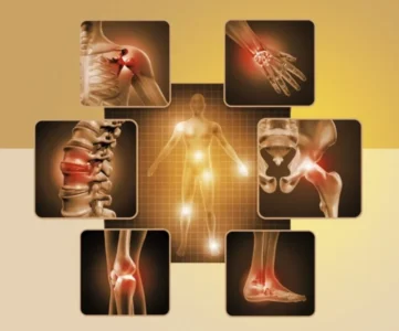 Assembleia Legislativa do Maranhão aprova projeto que garante validade indeterminada para laudo de fibromialgia