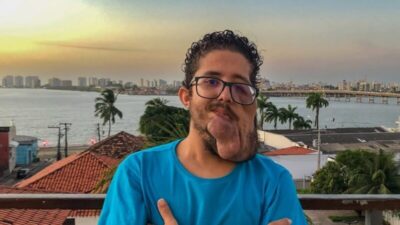 Corretor de Imóveis em São Luís busca ajuda para remoção de tumores na face