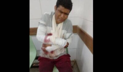 Ladrão quebra os dois braços após tentar fugir da polícia em São Luís