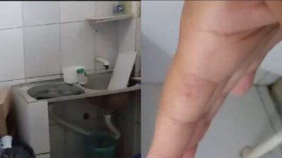 Servidora expõe acidente sofrido e estado de abandono da Câmara de Ribamar