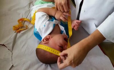 Governo pagará R$ 60 mil a famílias de crianças afetadas pelo Zika
