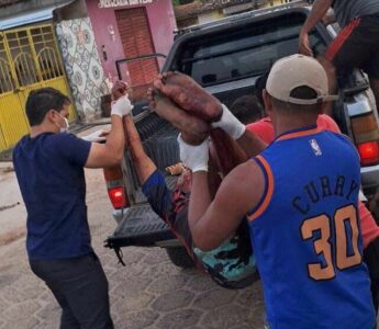 Homem é esfaqueado por assaltante em plena luz do dia em Central e levado em carroceria por falta de ambulância