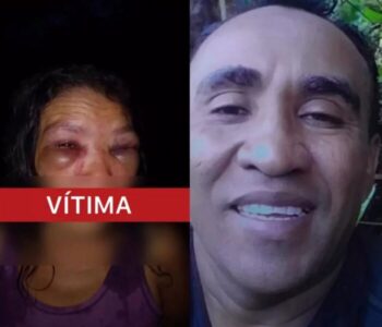 Homem agride esposa e a deixa quase cega após vários socos nos olhos