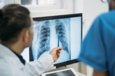 TUBERCULOSE: Maranhão registra quase 13 mil casos em 5 anos