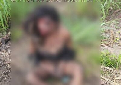 Indígena transexual estuprada e agredida no MA segue internada com várias fraturas e aguarda cirurgia