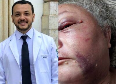 Médico que já foi preso por agredir a companheira agora espancou a própria mãe em Codó