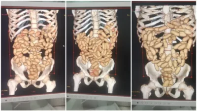 Homem foragido no Maranhão é preso pela Polícia Federal com barriga cheia de cocaína em aeroporto de São Paulo