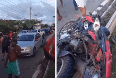 Pedreiro da cidade de São João Batista tem perna amputada após acidente em São Luís