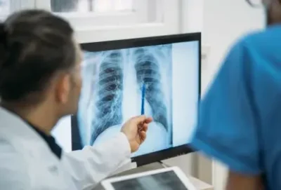 Maranhão registrou quase 13 mil casos de tuberculose em 5 anos