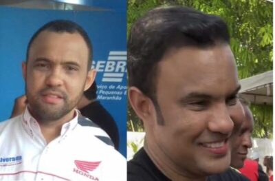 Depois da mansão de milhões, prefeito ostentação Edilson da Alvorada, aparece com implante capilar e harmonização facial em Palmeirândia