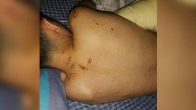Discussão em bar termina com dois esfaqueados e um preso em Vargem Grande