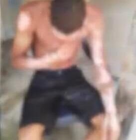 Uma mulher ateou fogo no ex-namorado, de 24 anos, no Bairro de Fátima, em São Luís, após ter sido agredida por ele, conforme relatos de testemunhas.