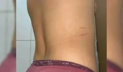 Jovem cai bêbada e é estuprada por morador de rua na saída de bar