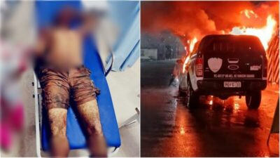 Suspeito de atear fogo em viatura é morto pela polícia