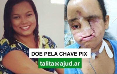 Moradora da Baixada Maranhense luta contra contra câncer raro e pede apoio para seguir tratamento